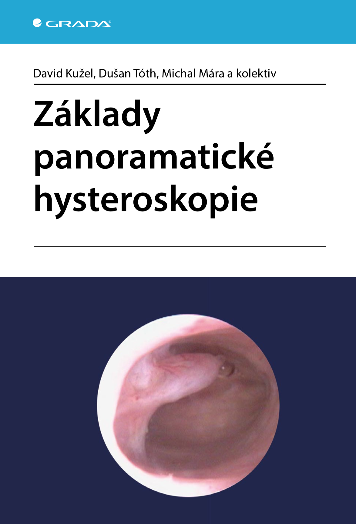 E-kniha Základy panoramatické hysteroskopie - kolektiv a, Michal Mára, David Kužel, Dušan Tóth